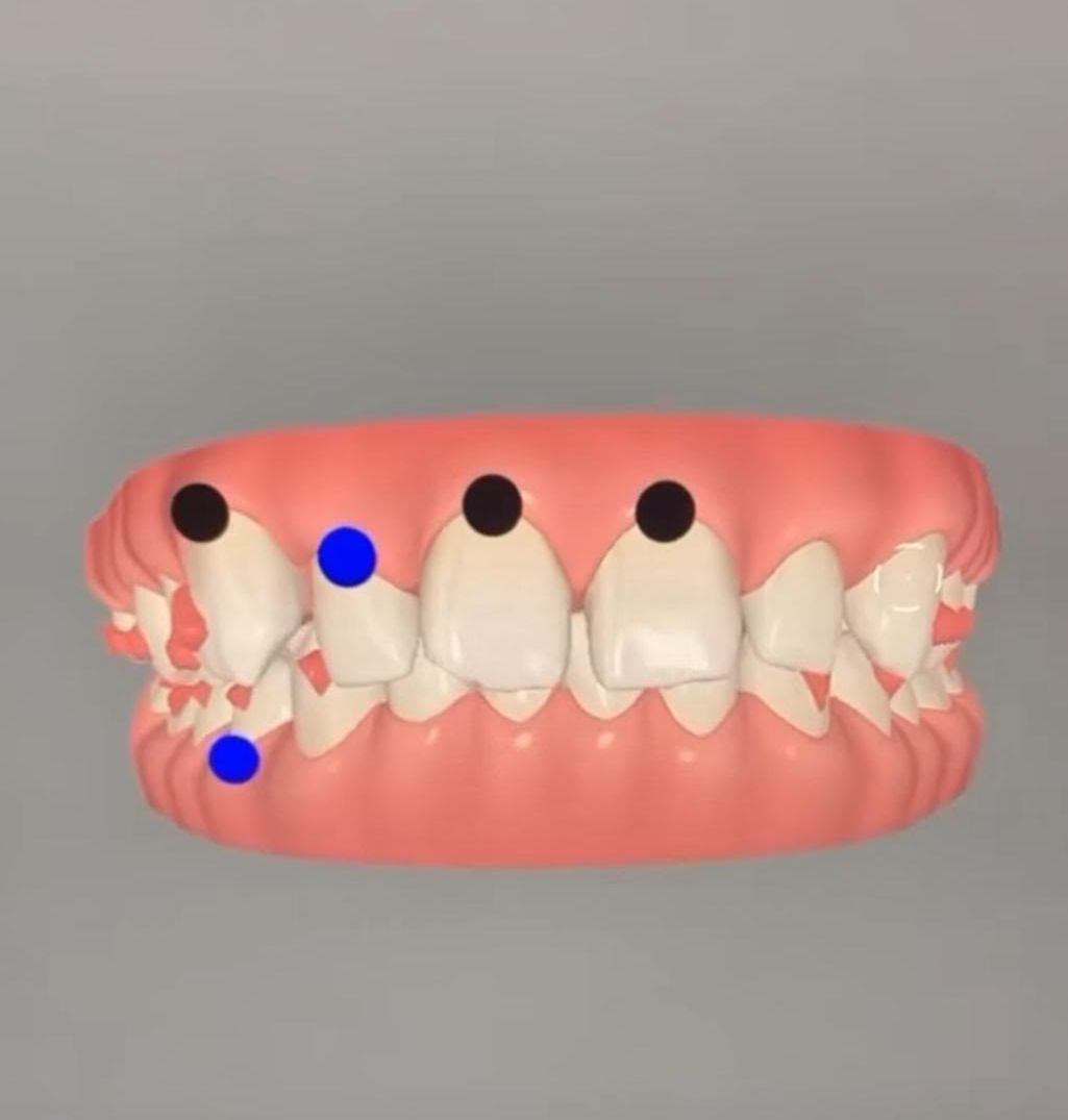 Planification numérique en 3D