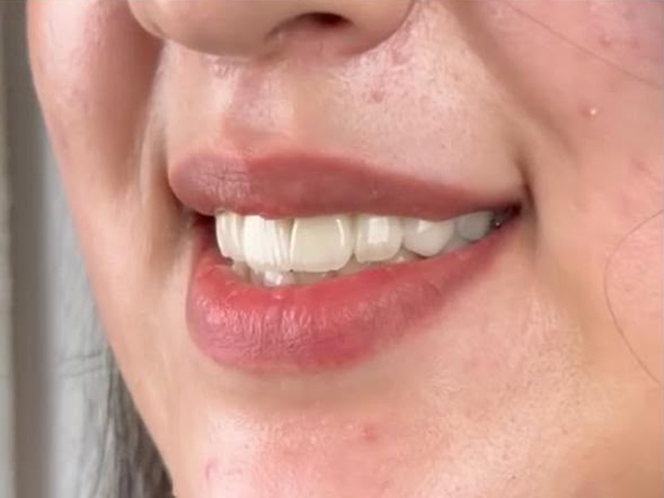 Sourire après un projet esthétique à la clinique